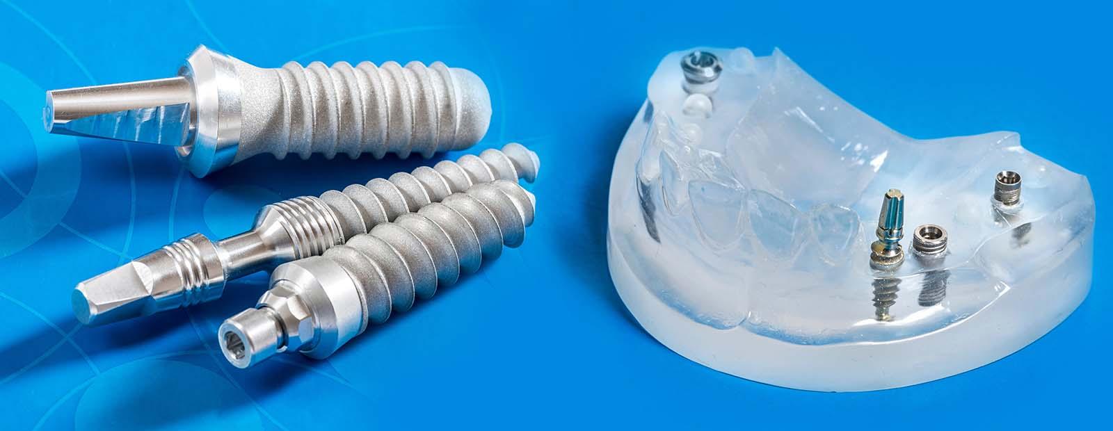 dental implants safety, dental implant risks, dental implant complications, dental implant recovery, implant dentistry benefits, dental implant success rate, safe dental implants, implant surgery risks, dental implant process, affordable dental implants