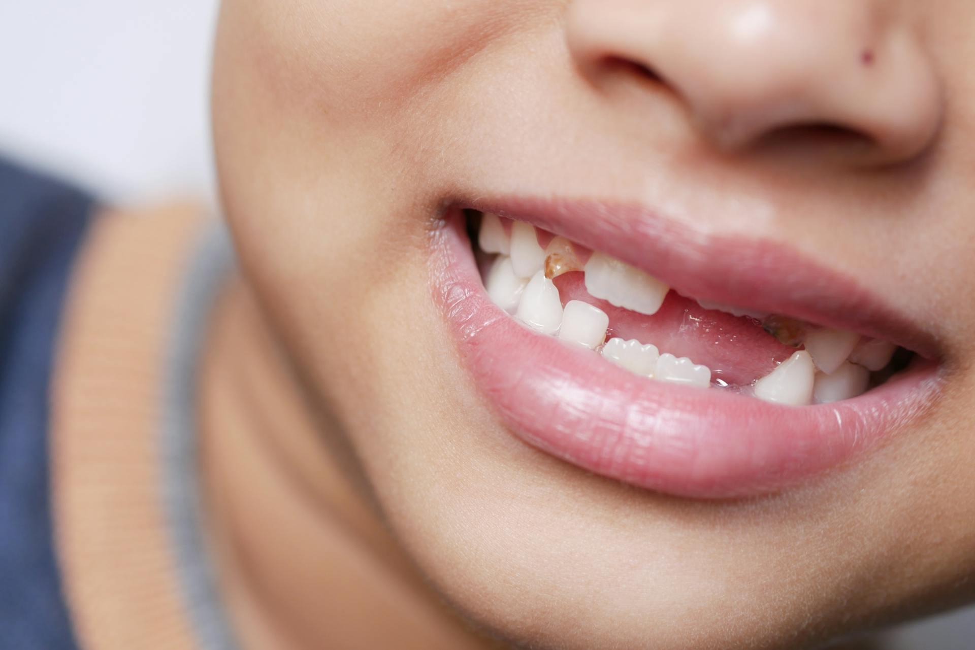 missing tooth bite problems, long-term dental risks missing tooth, tooth loss symptoms, dental treatment options missing tooth, bite correction after tooth loss, dental implants for missing teeth, tooth replacement solutions, impact of missing tooth, long-term oral health risks